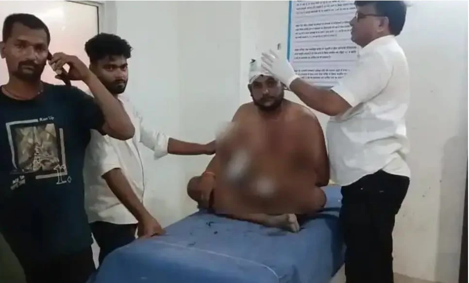 चंदौली: दुकान पर मामूली विवाद बना खूनी संघर्ष, दो पक्षों की भिड़ंत में 7 लोग घायल
